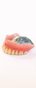 金属床義歯（チタンプレートデンチャー）