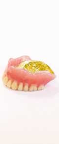 金属床義歯（ゴールドプレートデンチャー）