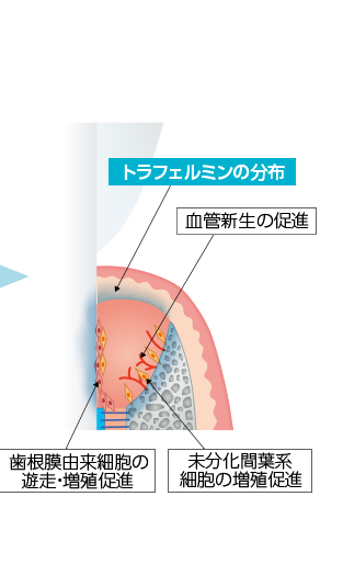 「トラフェルミン」による歯周組織再生の仕組み03